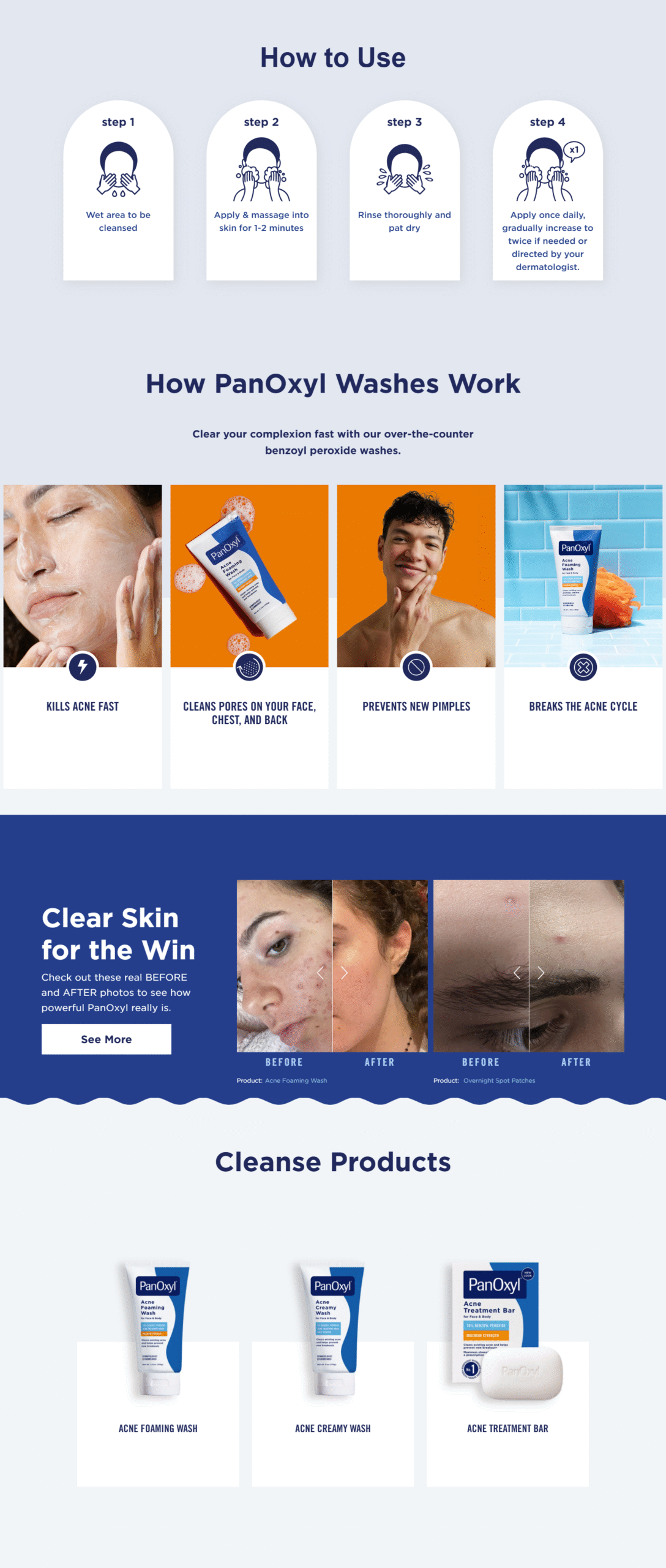 screencapture panoxyl acne products acne foaming wash benzoyl peroxide 2025 06 06 19 31 19 1 1 scaled